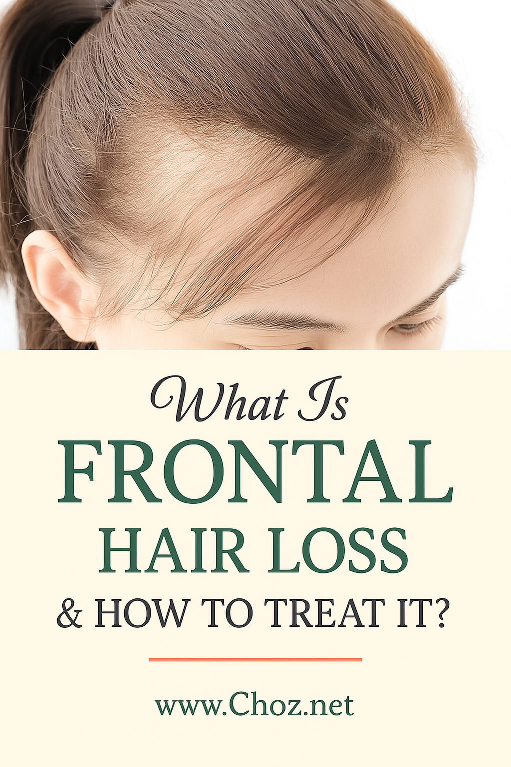 Frontal Hair Loss